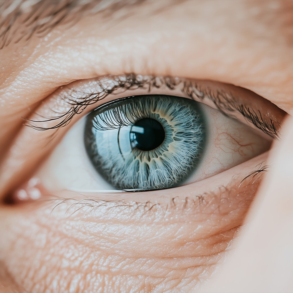 Ein Auge nach der Behandlung eines Kunden in Königsstein